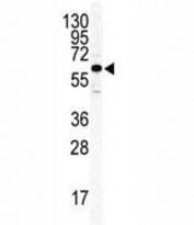 Western blot analysis of ILK2/ILK1 antibody and HeLa lysate.