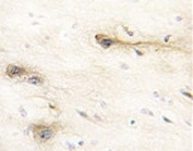 IHC analysis of FFPE human brain tissue stained with MARK1 antibody