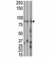 The MARK1 antibody used in western blot to detect MARK1 in HeLa, T47D, and mouse brain cell line/ tissue lysate (left to right)
