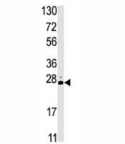 Western blot analysis of STK19 antibody and HL-60 lysate.
