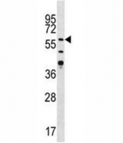 Western blot analysis of CAMK2G antibody in Jurkat lysate