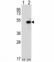 Western blot analysis of SPHK1 antibody and 293 cell lysate (2 ug/lane) either nontransfected (Lane 1) or transiently transfected (2) with the SPHK1 gene. Predicted molecular weight: ~43/51/44kDa (isoforms 1/2/3).