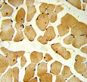 SPHK1 antibody IHC analysis in formalin fixed and paraffin embedded skeletal muscle.