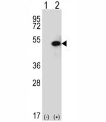 Western blot analysis of SPHK1 antibody and 293 cell lysate (2 ug/lane) either nontransfected (Lane 1) or transiently transfected (2) with the SPHK1 gene.