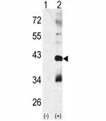 Western blot analysis of MAPK11 antibody and 293 cell lysate (2 ug/lane) either nontransfected (Lane 1) or transiently transfected with the MAPK11 gene (2).~