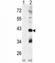 Western blot analysis of MAPK11 antibody and 293 cell lysate (2 ug/lane) either nontransfected (Lane 1) or transiently transfected with the MAPK11 gene (2).