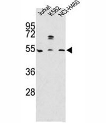 Western blot analysis of APOA4 antibody and Jurkat, K562, NCI-H460 lysate~