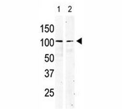 cKit antibody used in western blot to detect KIT in serum-starved HeLa cell lysate (lane 1) and primate testis tissue lysate (2).