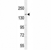 c-Kit antibody western blot analysis in mouse testis tissue lysate. Observed molecular weight: ~120/145kDa (precusor/mature).