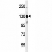 Western blot analysis of CD117 antibody and mouse cerebellum tissue lysate. Observed molecular weight: ~120/145kDa (precusor/mature).
