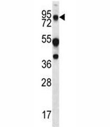 MUC20 antibody western blot analysis in WiDr lysate.