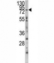 Western blot analysis of MYLK3 antibody and mouse heart tissue lysate