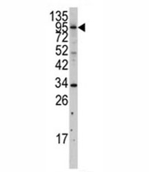 Western blot analysis of MYLK3 antibody and A375 lysate.