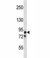 MARK2 antibody western blot analysis in Ramos lysate. Predicted molecular weight: ~88kDa (isoform 1/alpha).