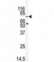 Western blot analysis of MARK2 antibody and mouse thymus tissue lysate. Predicted molecular weight: ~88kDa (isoform 1/alpha).