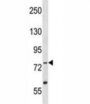 TLK2 antibody western blot analysis in Y79 lysate
