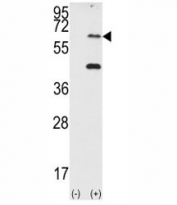 Western blot analysis of PKR antibody and 293 cell lysate (2 ug/lane) either nontransfected (Lane 1) or transiently transfected with the EIF2AK2/PKR gene (2). Predicted molecular weight ~62 kDa but routinely observed at 68-72 kDa.