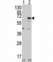 Western blot analysis of PRKR antibody and 293 cell lysate (2 ug/lane) either nontransfected (Lane 1) or transiently transfected with the EIF2AK2/PKR gene (2). Predicted molecular weight ~62 kDa but routinely observed at 68-72 kDa.