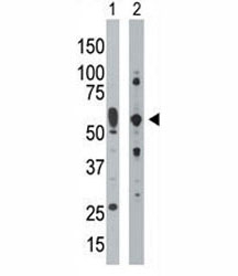 PRKR antibody used in western blot to detect PRKR/PKR in mouse uterus tissue lysate (Lane 1) and HepG2 cell lysate (2).
