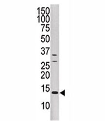 Western blot analysis of DUSP15 antibody and CEM cell line lysate.~