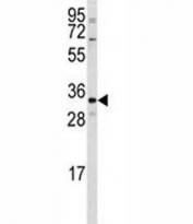 Western blot analysis of CTDSP2 antibody and HepG2 lysate