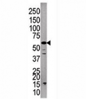 Western blot analysis of PPP3CC antibody and A375 lysate