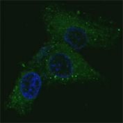 Fluorescent confocal image of HepG2 cells stained with MET antibody. MET is localized to the cytoplasm.