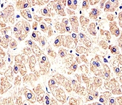 Immunohistochemical analysis of paraffin-embedded human liver using MET antibody at 1:25 dilution.