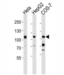 Western blot analysis of lysate from HeLa, HepG2, COS-7 cell line (left to right) using MET antibody at 1:1000 for each lane.