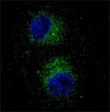 Fluorescent confocal image of HepG2 cells stained with MET antibody. Note the highly specific localization of the MET immunosignal to the cytoplasm~