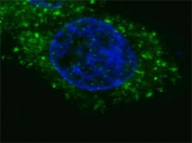 Fluorescent confocal image of HepG2 cells stained with HGFR / MET antibody. Note the highly specific localization of the MET immunosignal to the cytoplasm.