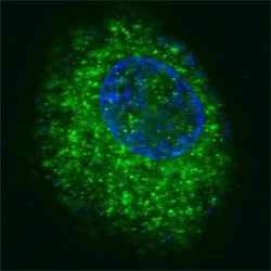 Fluorescent confocal image of HepG2 cells stained with HGFR antibody. HGFR is localized to the cytoplasm