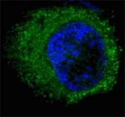 Fluorescent confocal image of HepG2 cells stained with HGFR antibody. Note the highly specific localization of the MET/HGFR immunosignal to the cytoplasm.