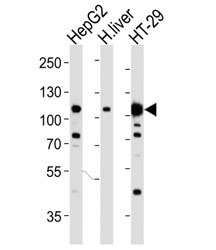 Western blot analysis of lysate from HepG2, human liver, HT-29 cell line (left to right) using HGFR antibody~