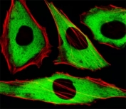 Fluorescent image of HeLa cells stained with XAF1 GAPDH antibody. Ab was diluted at 1:25 dilution; Alexa Fluor 488-conjugated secondary Ab (green); Cytoplasmic actin was counterstained with Alexa Fluor 555 conjugated with Phalloidin (red).