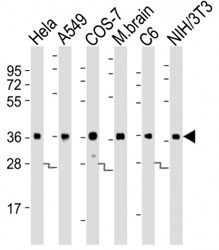 Western blot testing of GAPDH antibody at 1:8000 dilution. Lane 1: HeLa lysate; 2: A549; 3: COS-7; 4: mouse brain; 5: rat C6; 6: NIH3T3; Predicted band size : 36 kDa.