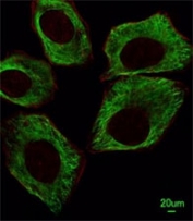Immunofluorescent analysis of A549 cells using beta-Tubulin antibody at 1:25 dilution. Dylight Fluor 488-conjugated goat anti-mouse lgG was used as the secondary Ab (green). Cytoplasmic actin was counterstained with Dylight 554 (red) conjugated Phalloidin (red).