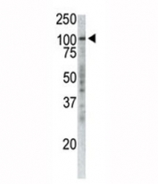 Western analysis of extracts from Jurkat cells using p100 antibody.