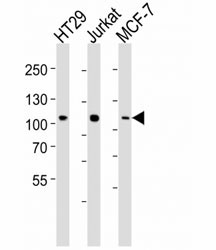 Western blot analysis of lysate from HT29, Jurkat, MCF-7 cell line (left to right) using TPX2 antibody~