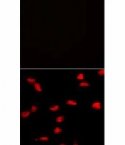 Immunofluorescence analysis of SET07 antibody and HeLa cells with (bottom) and without (top) PE-conjugated goat anti-mouse lgG secondary.
