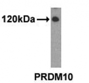 Western analysis of extracts from 293 cells using PRDM10 antibody.