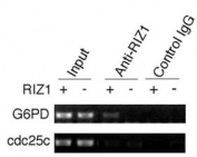 ChIP analysis was performed on RIZ1 knockout mouse embryonic fibroblasts with RIZ1 antibody. Immunoprecipitated chromatin DNA was analyzed by PCR with primers in the G6pd promoter region and in the Cdc25c promoter region.