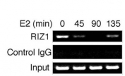 Time course analysis of RIZ1 binding to the pS2 gene promoter. MCF7 cells treated with E2 for different periods of time, as indicated at the top of each lane, were processed for ChIP analysis. Immunoprecipitation was performed with RIZ1 antibody and control immunoglobulin G as indicated.