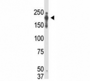 Western blot analysis of PRDM2 / RIZ1 antibody and transfected cell lysate