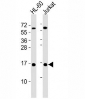 Western blot testing of SUMO1 antibody at 1:4000 dilution. Lane 1: HL-60 lysate; 2: Jurkat lysate