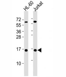 Western blot testing of SUMO1 antibody at 1:4000 dilution. Lane 1: HL-60 lysate;