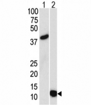 Western blot analysis of SUMO3 antibody and (1) GST-SUMO3 recombinant protein and (2) HL-60 lysate.