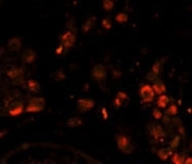 Immunofluorescence analysis of LIN28A antibody with paraffin-embedded human testis tissue. Primary antibody was followed by PE-conjugated goat anti-mouse lgG. PE emits orange fluorescence.