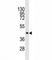 Western blot analysis of NANOG antibody and human recombinant protein.