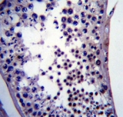 NANOG antibody immunohistochemistry analysis in formalin fixed and paraffin embedded human testis tissue.